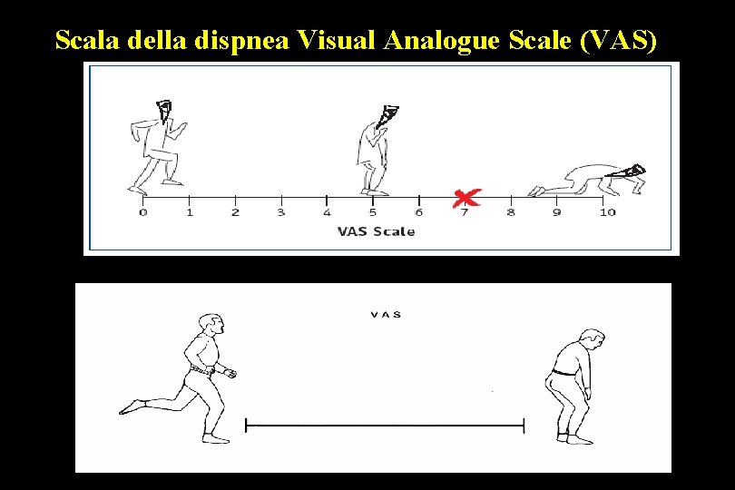 Scala della dispnea Visual Analogue Scale (VAS) 