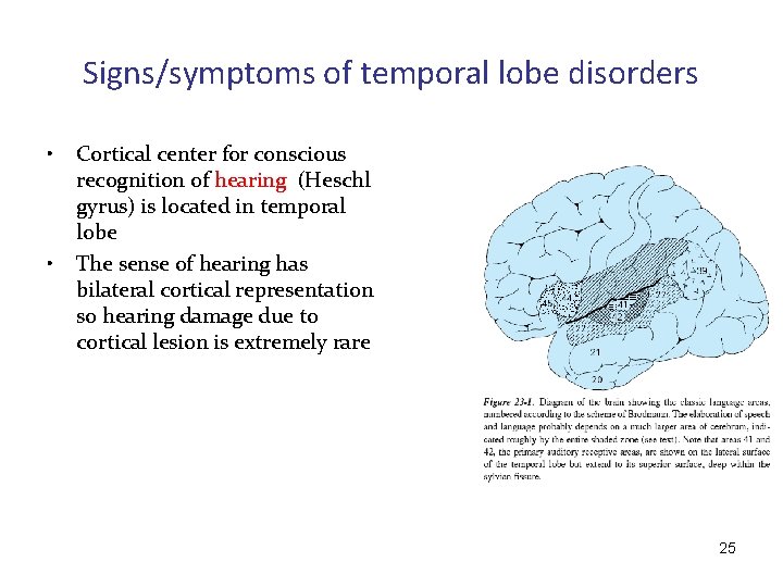 Signs/symptoms of temporal lobe disorders • • Cortical center for conscious recognition of hearing
