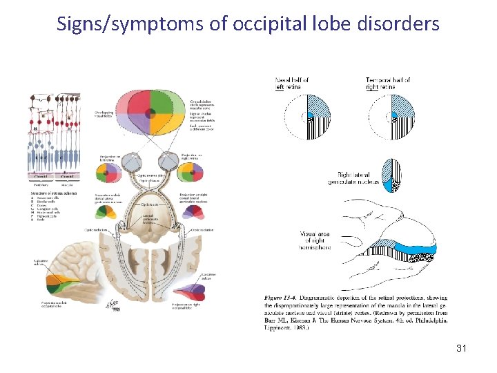 Signs/symptoms of occipital lobe disorders 31 
