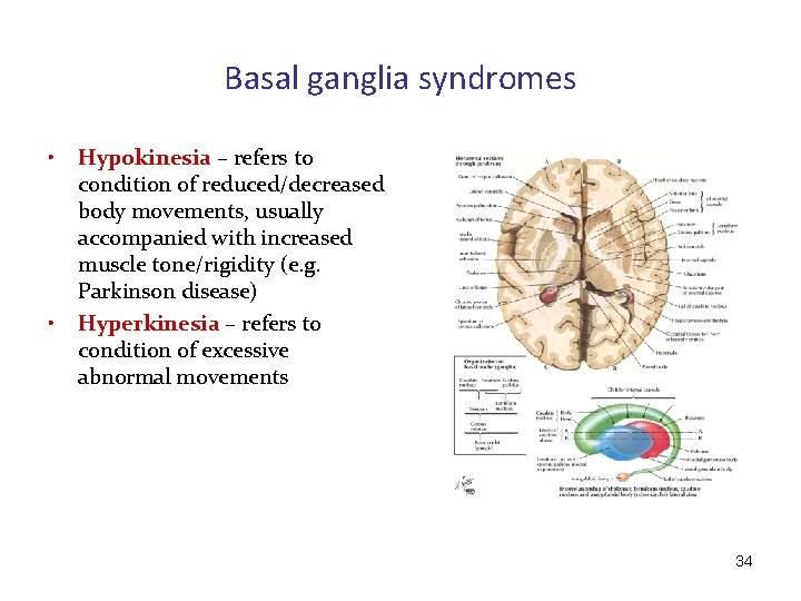 Basal ganglia syndromes • • Hypokinesia – refers to condition of reduced/decreased body movements,