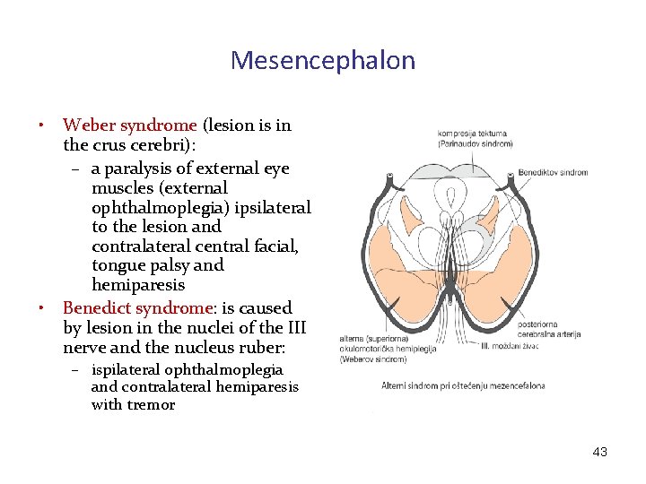 Mesencephalon • • Weber syndrome (lesion is in the crus cerebri): – a paralysis