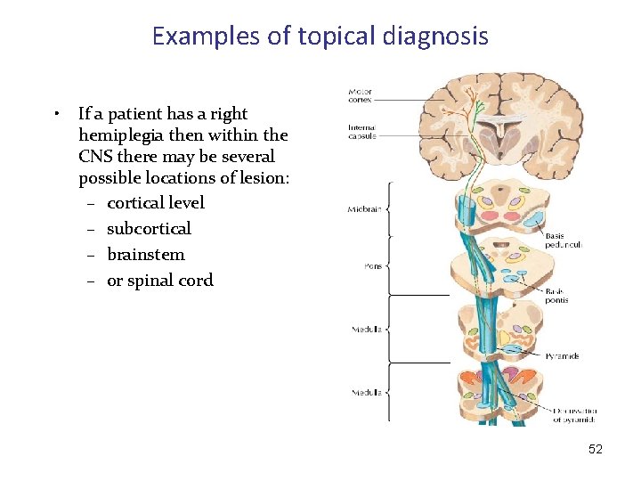 Examples of topical diagnosis • If a patient has a right hemiplegia then within