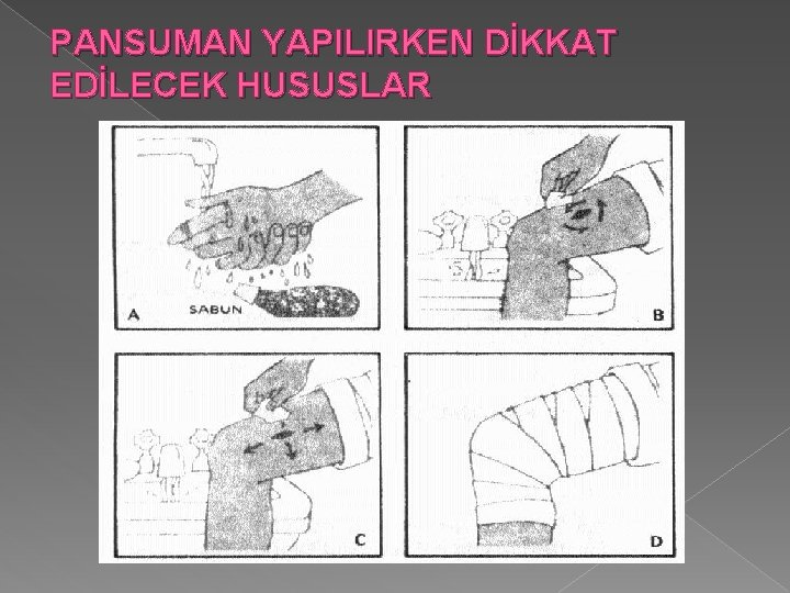 PANSUMAN YAPILIRKEN DİKKAT EDİLECEK HUSUSLAR 