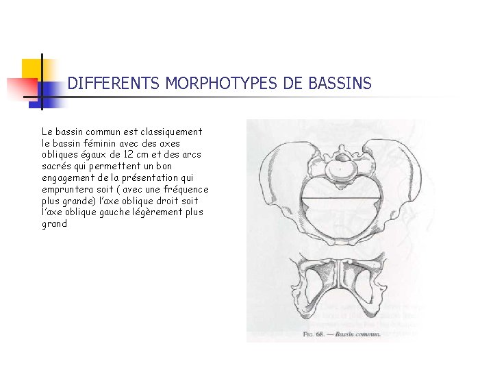 DIFFERENTS MORPHOTYPES DE BASSINS Le bassin commun est classiquement le bassin féminin avec des