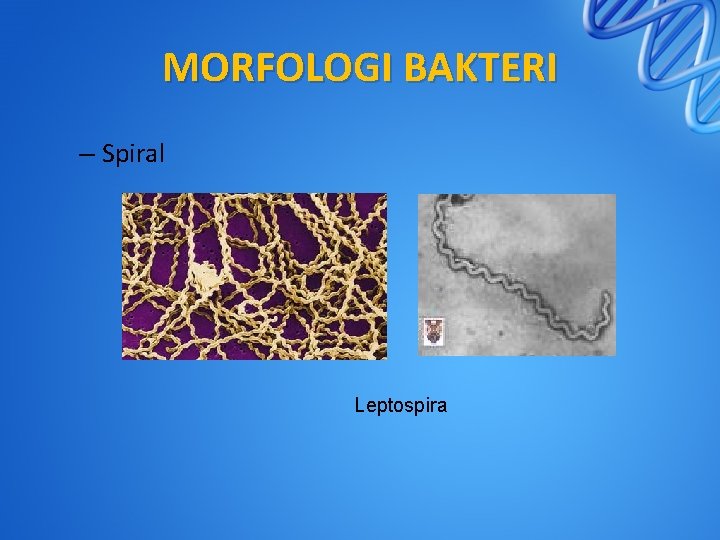 MORFOLOGI BAKTERI – Spiral Leptospira 