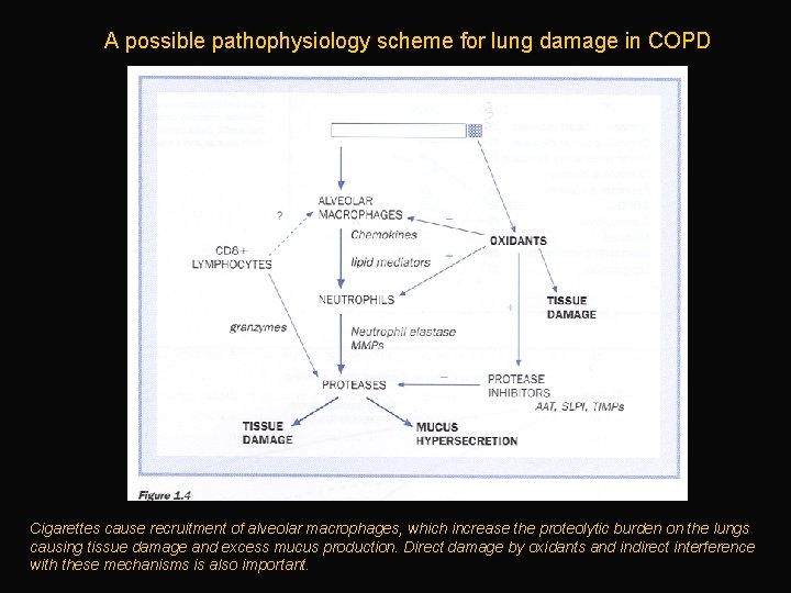A possible pathophysiology scheme for lung damage in COPD Cigarettes cause recruitment of alveolar