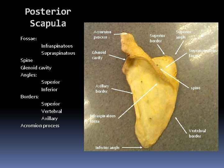 Posterior Scapula Acromion process Fossae: Infraspinatous Supraspinatous Spine Glenoid cavity Angles: Superior Inferior Borders: