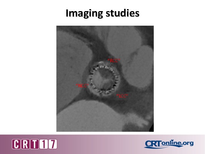 Imaging studies “RCC” “NCC” “LCC” 