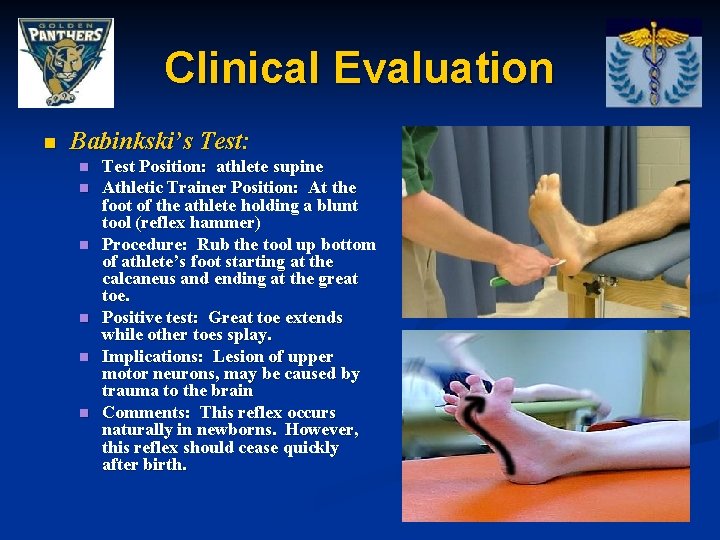 Clinical Evaluation n Babinkski’s Test: n n n Test Position: athlete supine Athletic Trainer