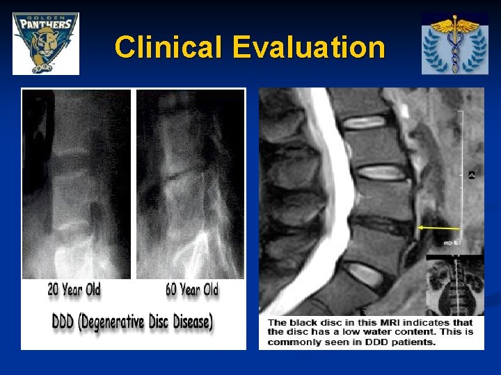 Clinical Evaluation 