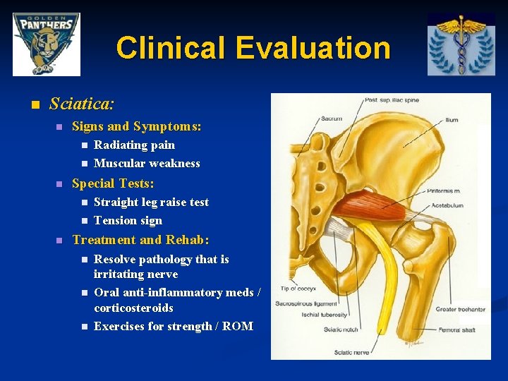 Clinical Evaluation n Sciatica: n Signs and Symptoms: n n n Special Tests: n