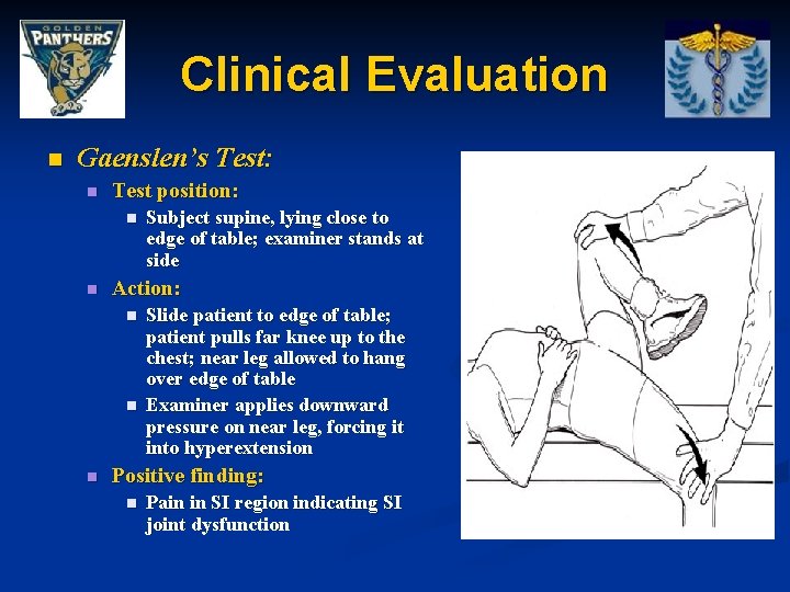 Clinical Evaluation n Gaenslen’s Test: n Test position: n n Action: n n n