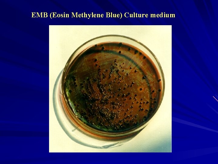 EMB (Eosin Methylene Blue) Culture medium 