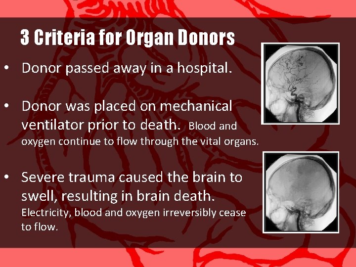 3 Criteria for Organ Donors • Donor passed away in a hospital. • Donor