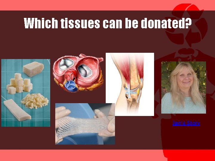 Which tissues can be donated? Jan’s Story 