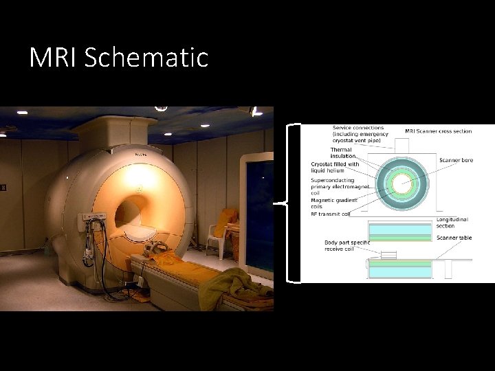 MRI Schematic 
