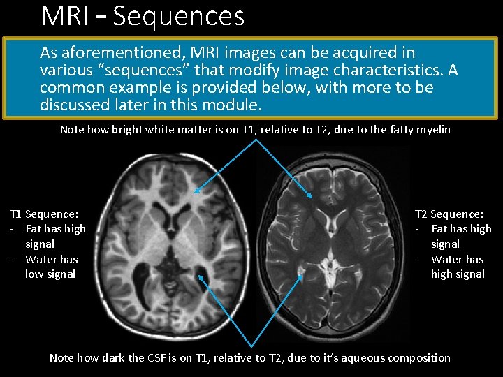 MRI – Sequences As aforementioned, MRI images can be acquired in various “sequences” that