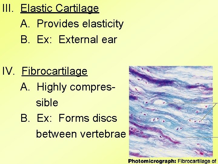 III. Elastic Cartilage A. Provides elasticity B. Ex: External ear IV. Fibrocartilage A. Highly III. Elastic Cartilage A. Provides elasticity B. Ex: External ear IV. Fibrocartilage A. Highly