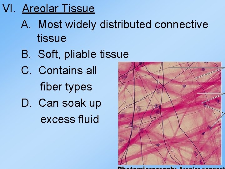 VI. Areolar Tissue A. Most widely distributed connective tissue B. Soft, pliable tissue C. VI. Areolar Tissue A. Most widely distributed connective tissue B. Soft, pliable tissue C.