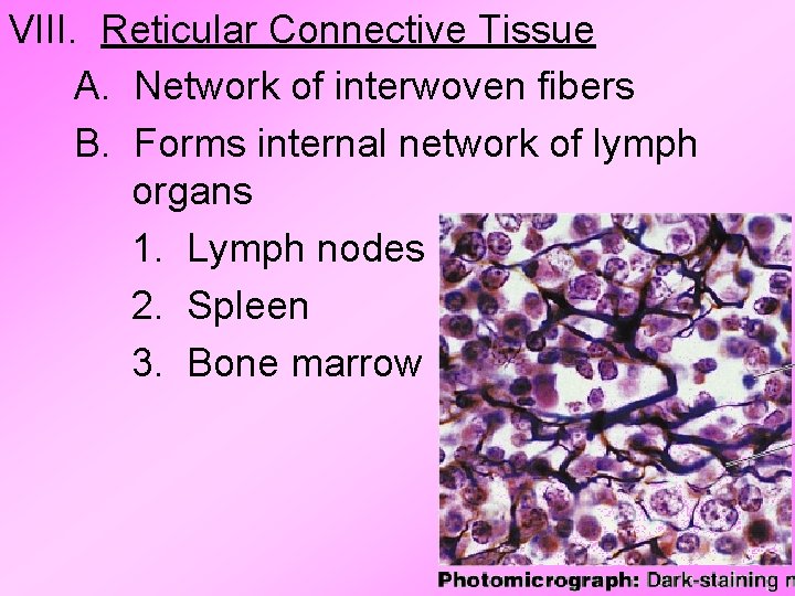 VIII. Reticular Connective Tissue A. Network of interwoven fibers B. Forms internal network of VIII. Reticular Connective Tissue A. Network of interwoven fibers B. Forms internal network of
