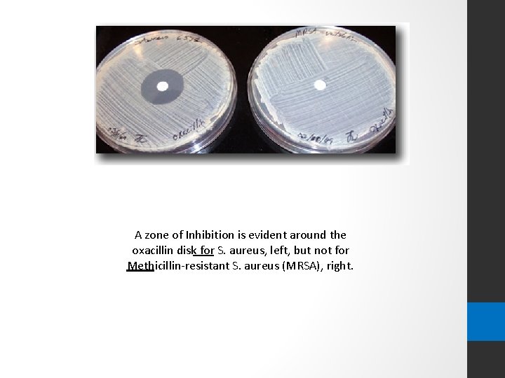 A zone of Inhibition is evident around the oxacillin disk for S. aureus, left,