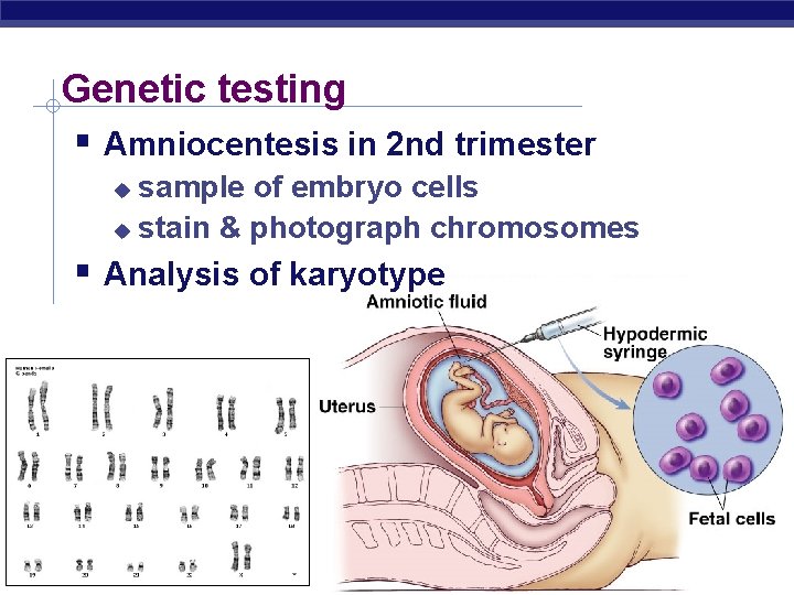 Genetic testing Amniocentesis in 2 nd trimester sample of embryo cells stain & photograph