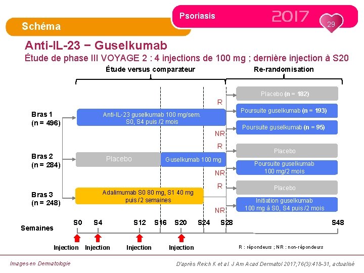 Psoriasis 29 Schéma Anti-IL-23 − Guselkumab Étude de phase III VOYAGE 2 : 4