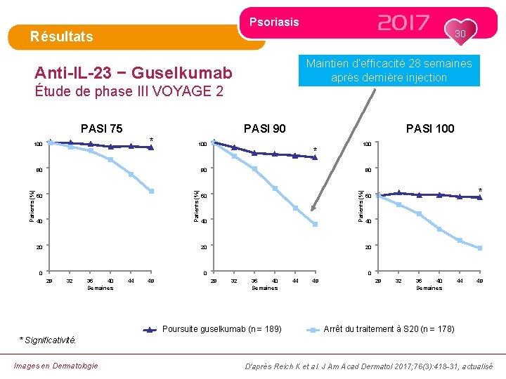 Psoriasis 30 Résultats Maintien d’efficacité 28 semaines après dernière injection Anti-IL-23 − Guselkumab Étude