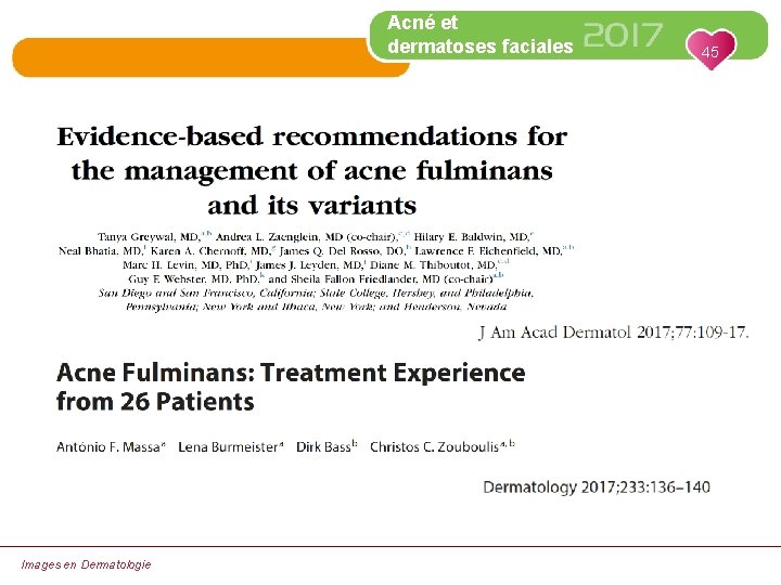 Acné et dermatoses faciales Images en Dermatologie 45 