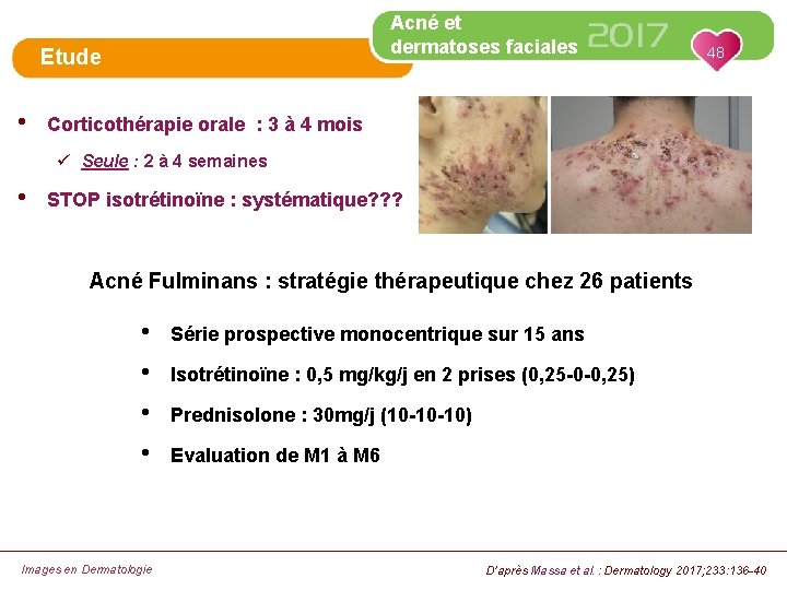 Acné et dermatoses faciales Etude • 48 Corticothérapie orale : 3 à 4 mois