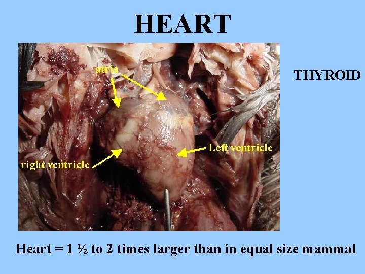 HEART THYROID Heart = 1 ½ to 2 times larger than in equal size