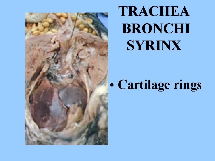 TRACHEA BRONCHI SYRINX • Cartilage rings 