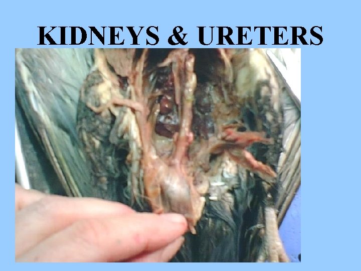 KIDNEYS & URETERS 