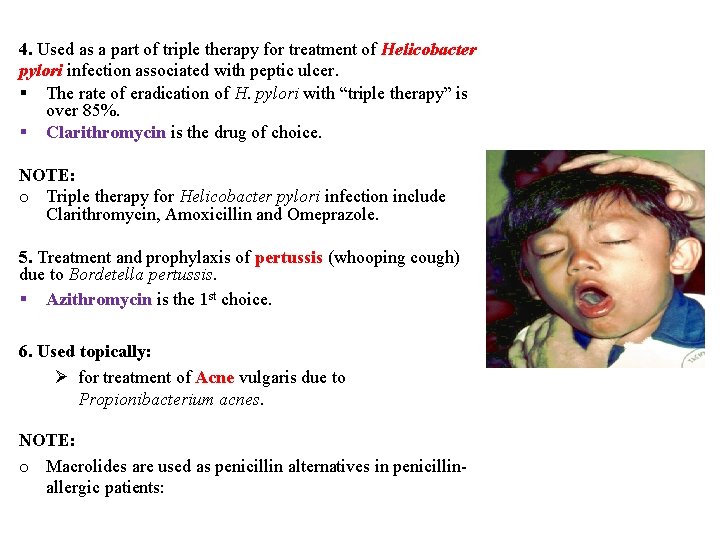 4. Used as a part of triple therapy for treatment of Helicobacter pylori infection