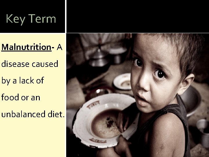 Key Term Malnutrition- A disease caused by a lack of food or an unbalanced