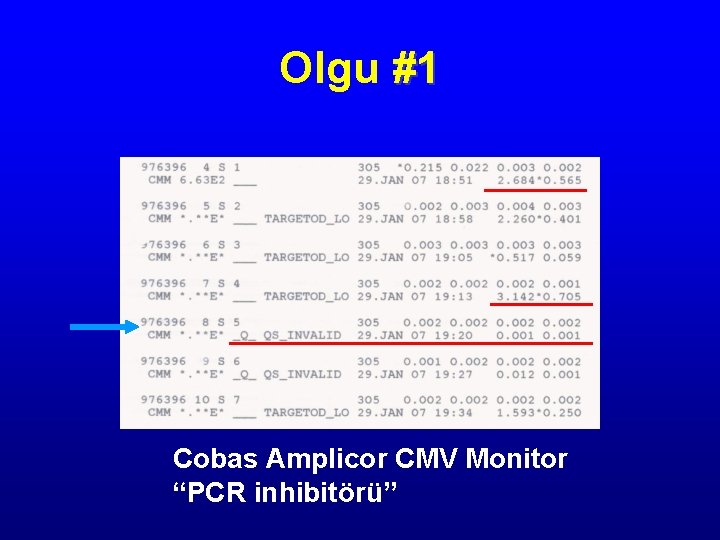 Olgu #1 Cobas Amplicor CMV Monitor “PCR inhibitörü” 