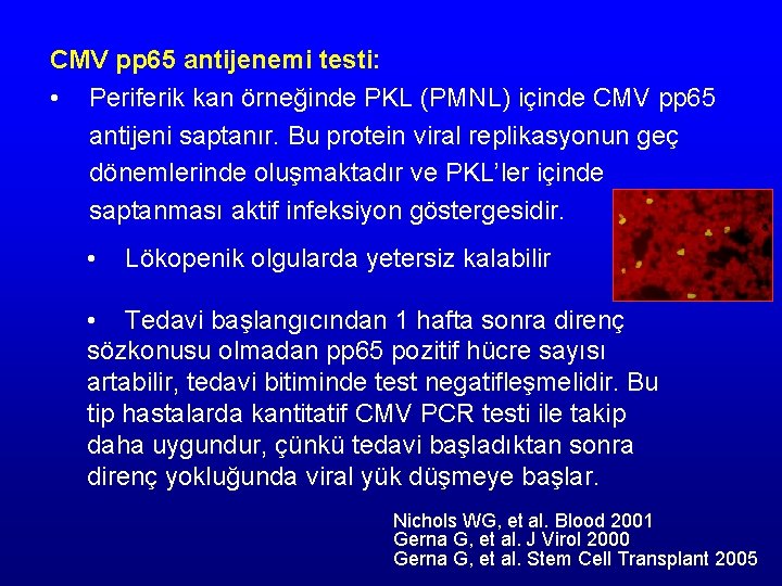 CMV pp 65 antijenemi testi: • Periferik kan örneğinde PKL (PMNL) içinde CMV pp