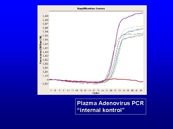 Plazma Adenovirus PCR “internal kontrol” 