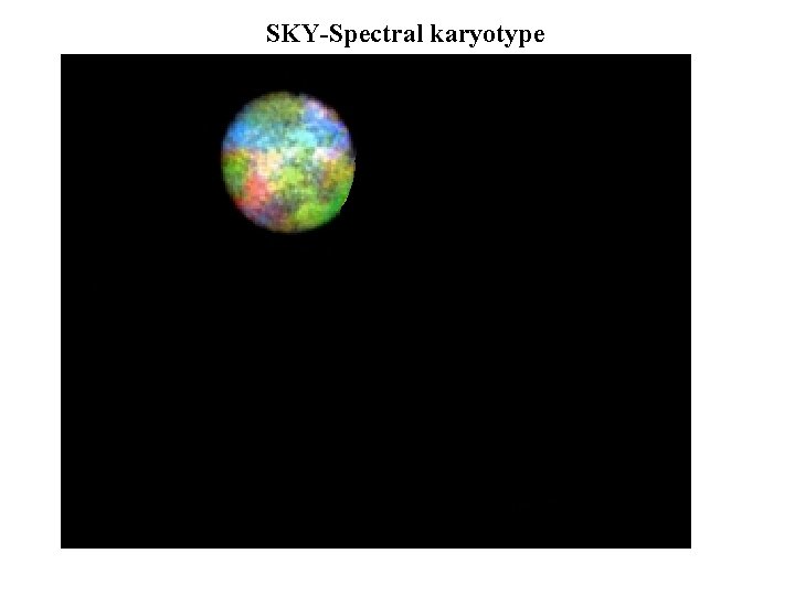 SKY-Spectral karyotype 