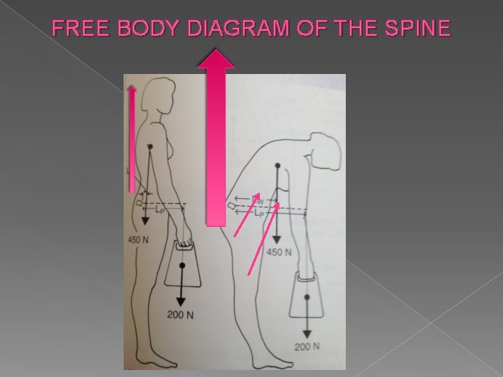 FREE BODY DIAGRAM OF THE SPINE 