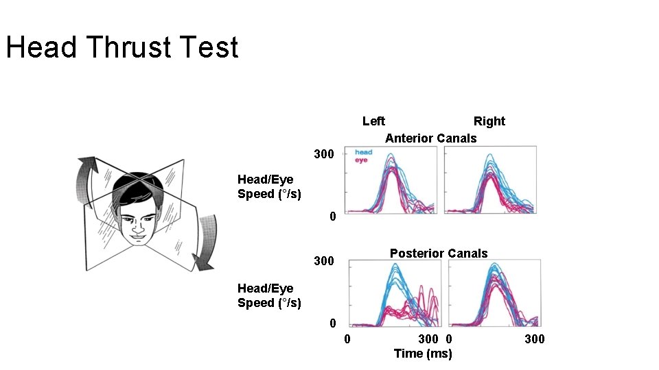 Head Thrust Test Left Right Anterior Canals 300 Head/Eye Speed (°/s) 0 Posterior Canals