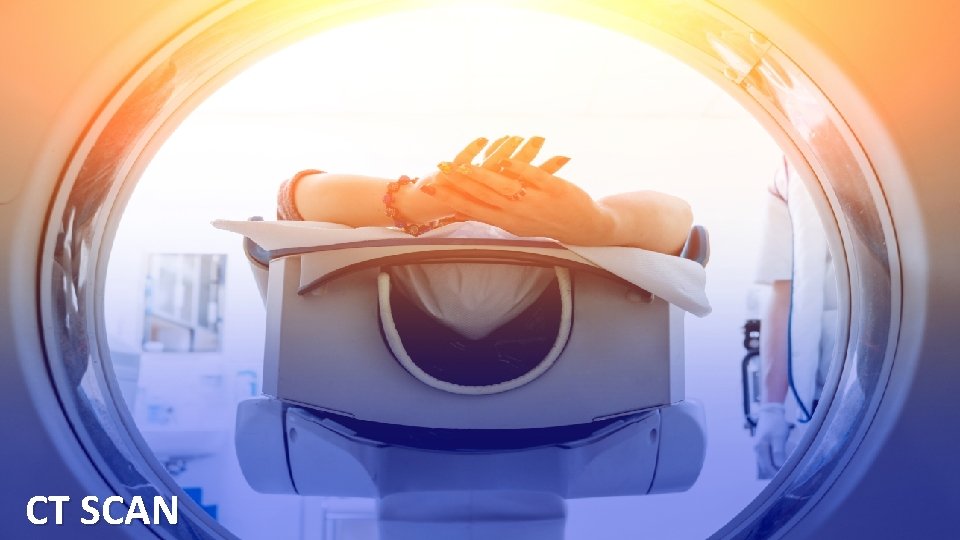 CT SCAN 