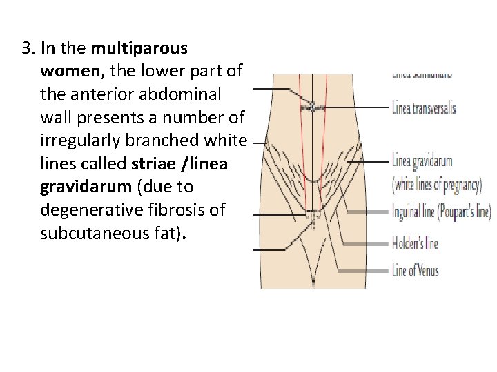 3. In the multiparous women, the lower part of the anterior abdominal wall presents 3. In the multiparous women, the lower part of the anterior abdominal wall presents