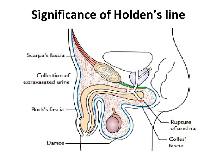Significance of Holden’s line  Significance of Holden’s line