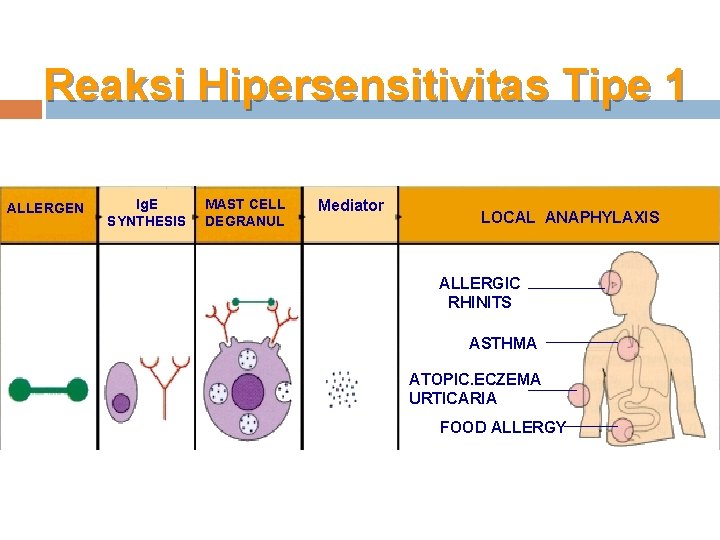 Reaksi Hipersensitivitas Tipe 1 ALLERGEN Ig. E SYNTHESIS MAST CELL DEGRANUL Mediator LOCAL ANAPHYLAXIS