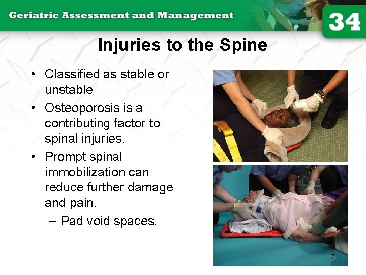 Injuries to the Spine • Classified as stable or unstable • Osteoporosis is a