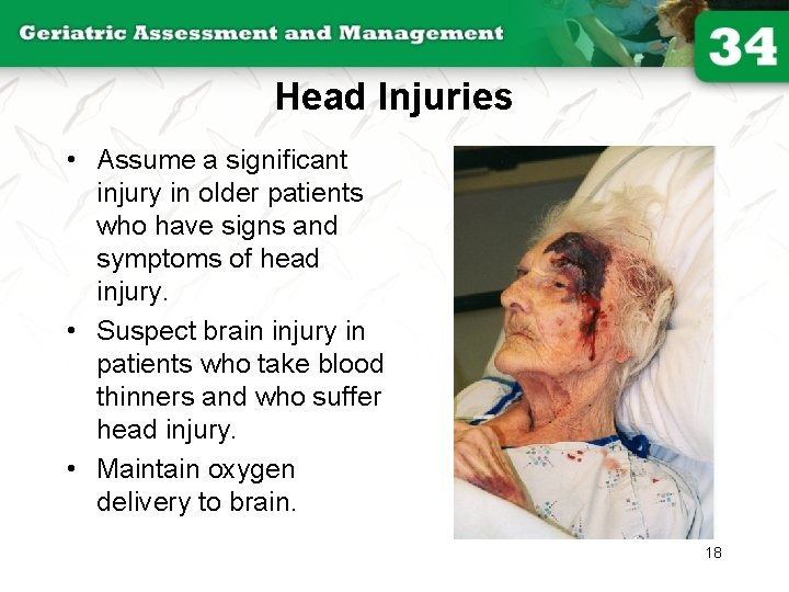 Head Injuries • Assume a significant injury in older patients who have signs and