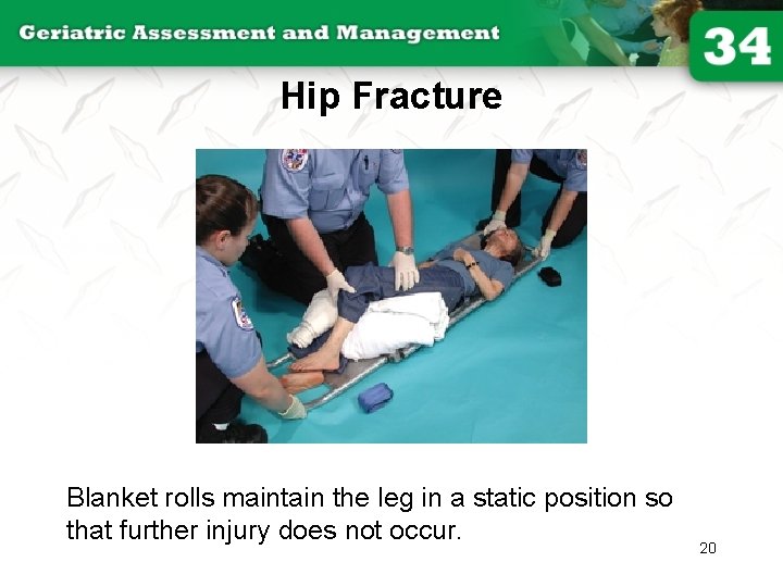Hip Fracture Blanket rolls maintain the leg in a static position so that further