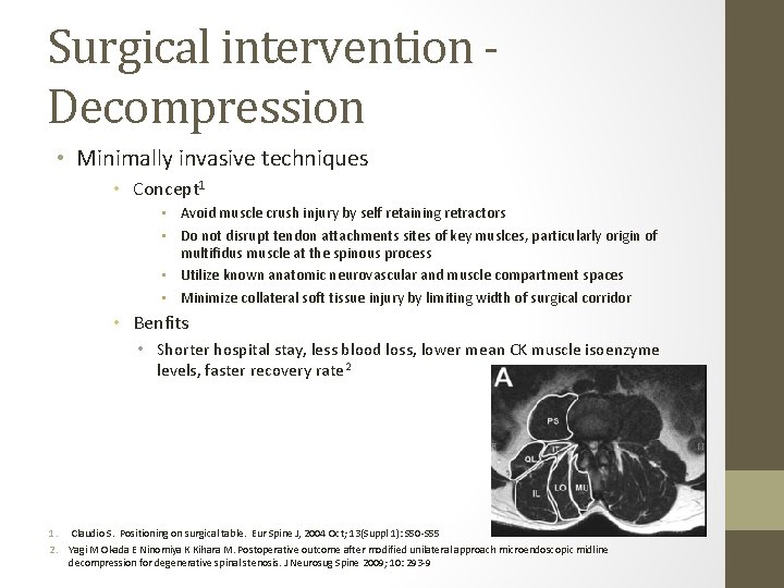 Surgical intervention Decompression • Minimally invasive techniques • Concept 1 • Avoid muscle crush