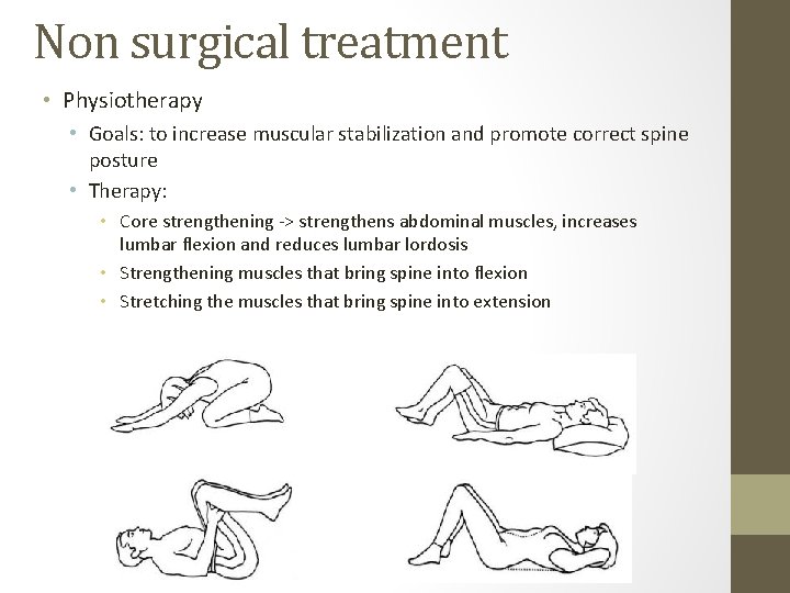 Non surgical treatment • Physiotherapy • Goals: to increase muscular stabilization and promote correct